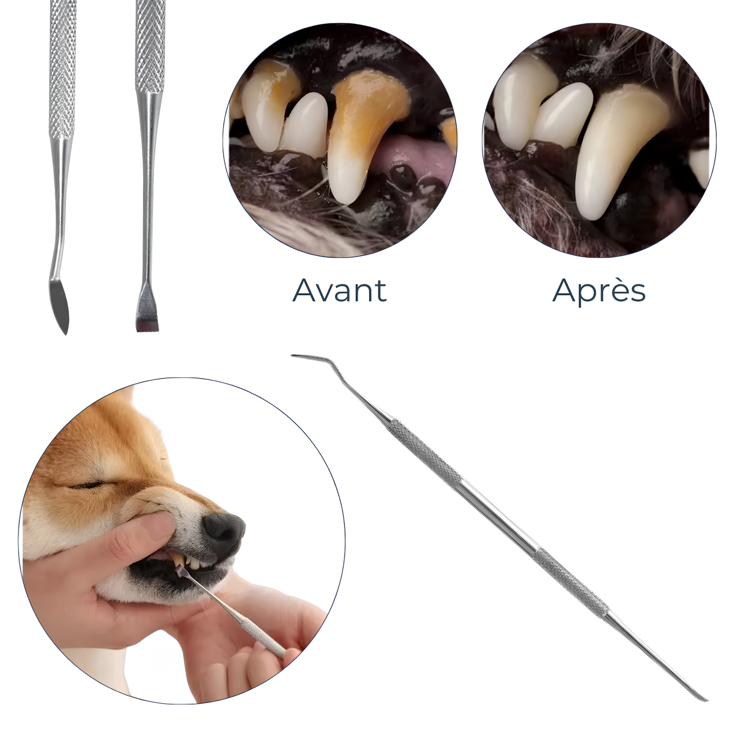 Grattoir à Dents en Acier Inoxydable